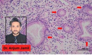First Detection of Enzootic Nasal Tumor Virus (ENTV) in Pakistan