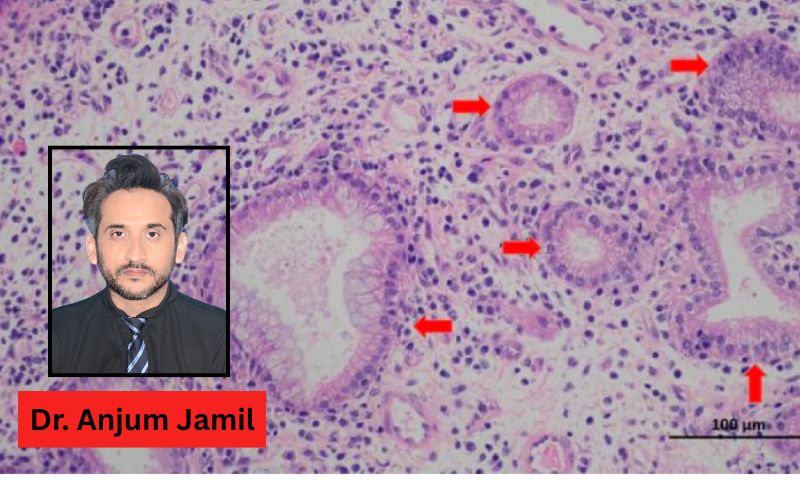 First Detection of Enzootic Nasal Tumor Virus (ENTV) in Pakistan